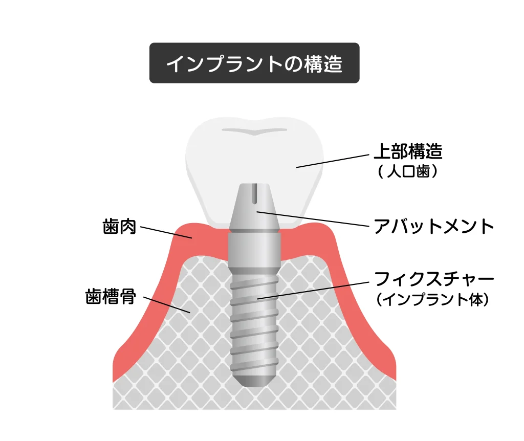 上部構造の作成