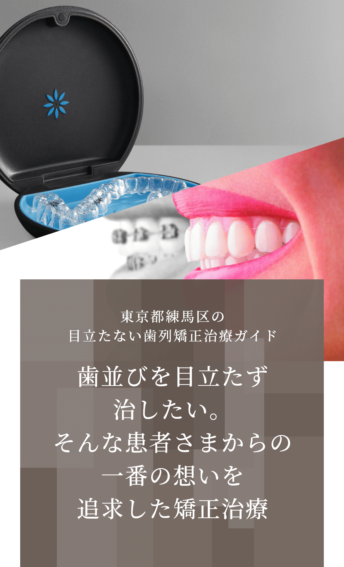 東京都練馬区の目立たない歯列矯正治療ガイド 歯並びを目立たず治したい。そんな患者さまからの一番の想いを追求した矯正治療